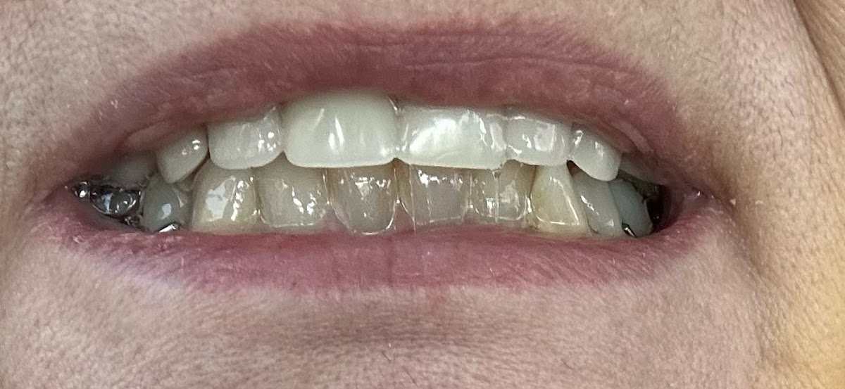 Palmetto Denture Care PA photo 5