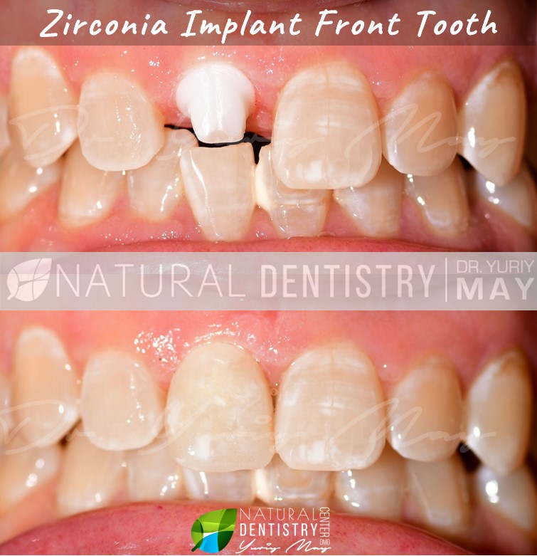 Ceramic Implant Institute photo 3