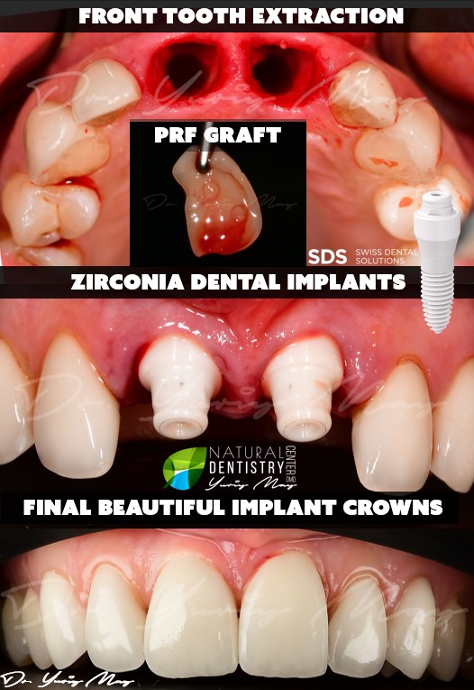 Ceramic Implant Institute photo 4