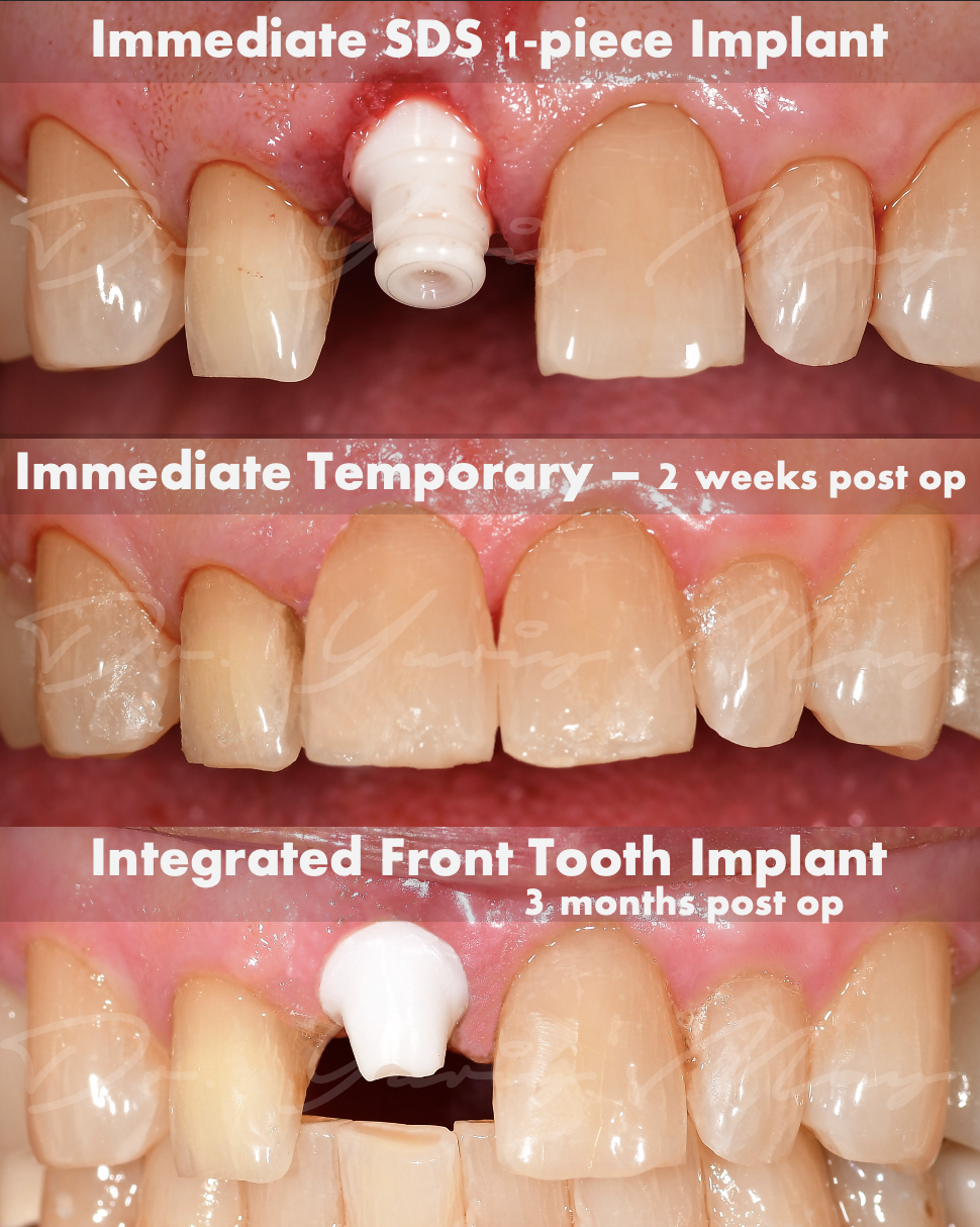 Ceramic Implant Institute photo 5