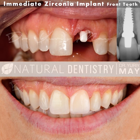 Ceramic Implant Institute photo 6