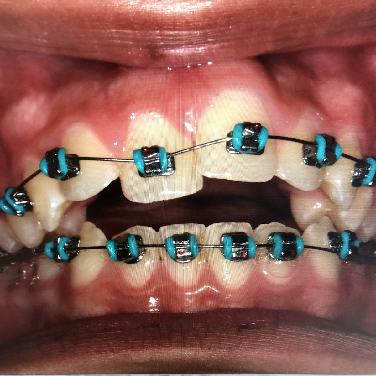 Westlake Family Dentistry photo 5