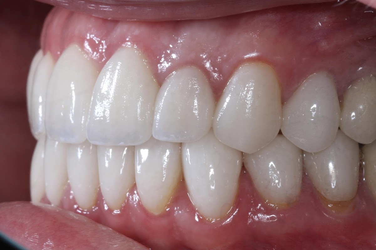 Pinnacle Dental Group photo 2