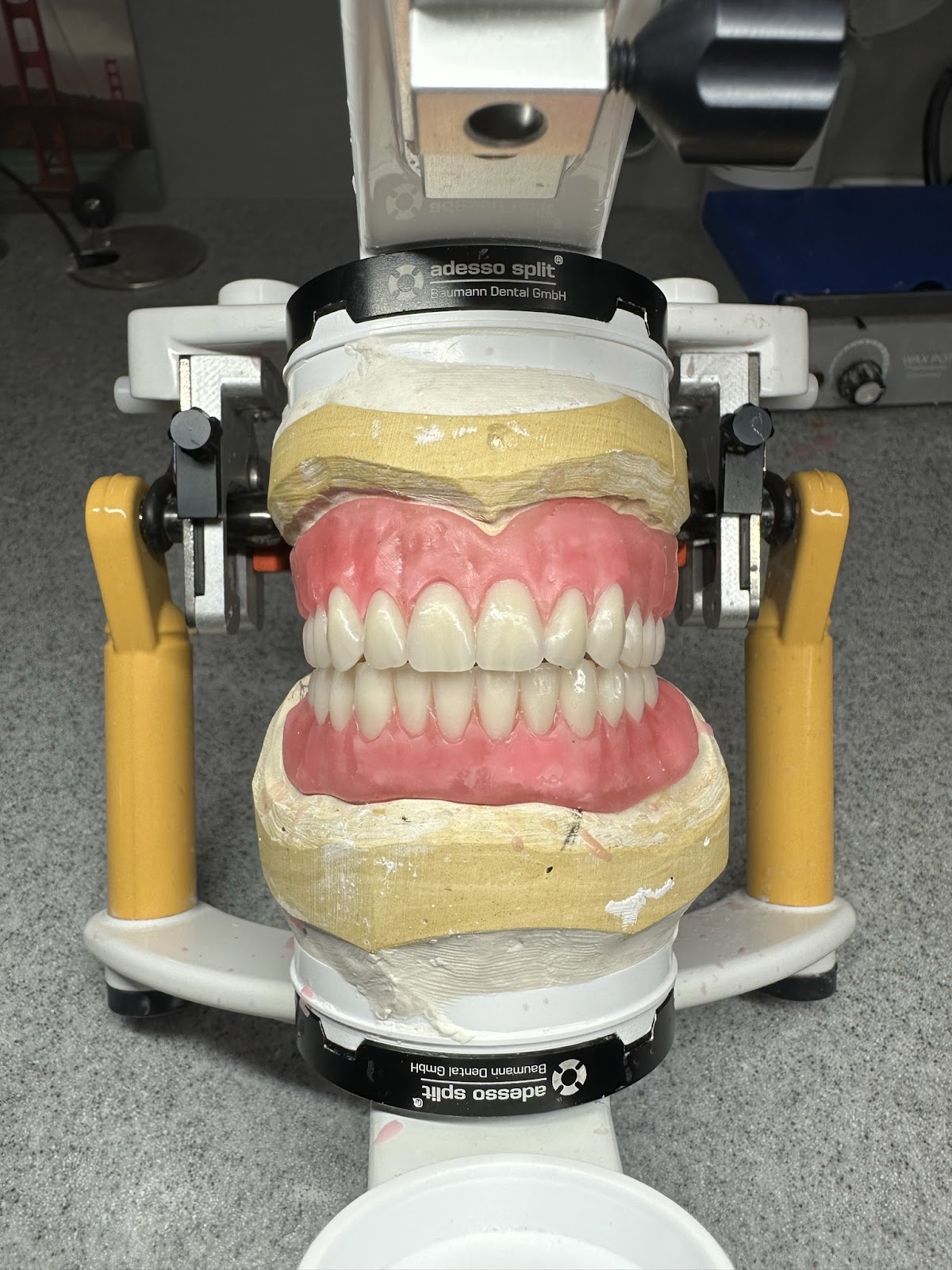 Smile More Dentures photo 3