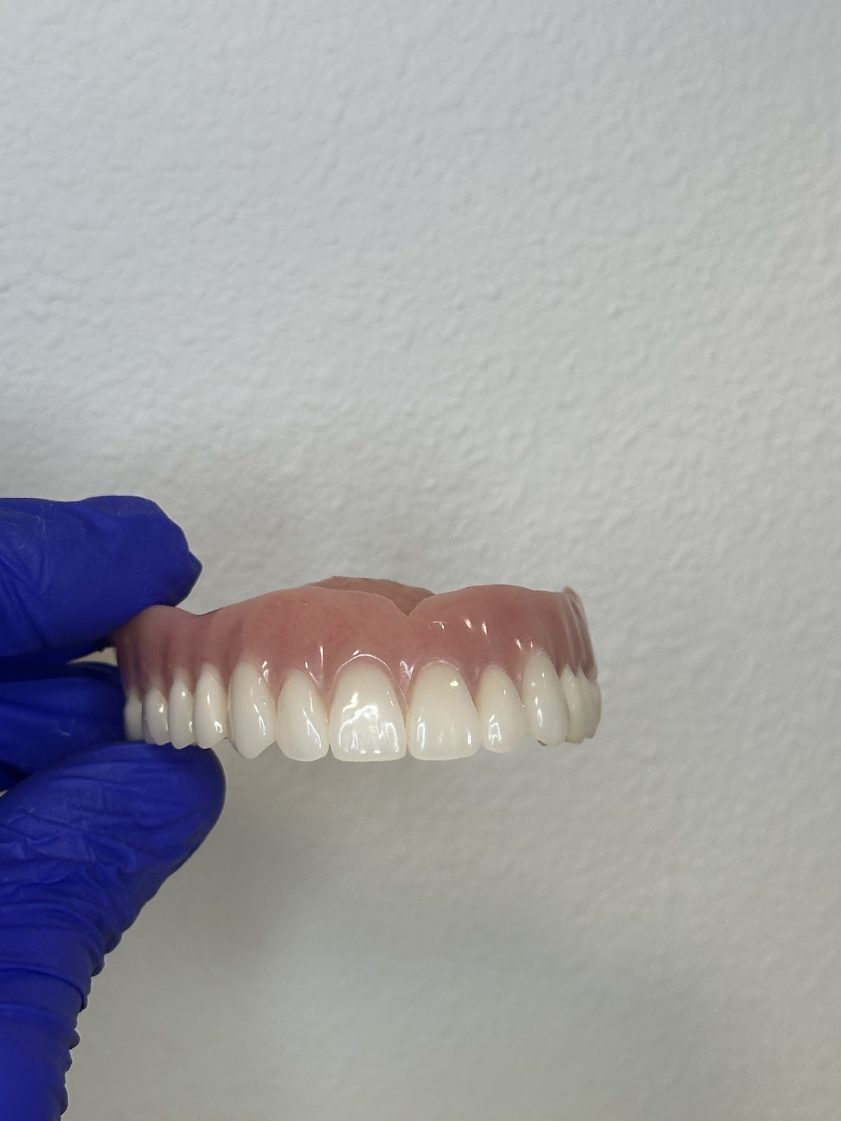 Smile More Dentures photo 5