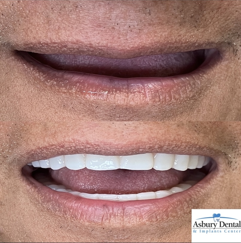 Asbury Dental and Implants Center- Dental Implants Green Cove Springs & Jacksonville photo 5