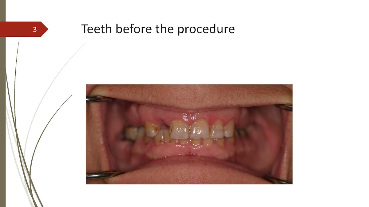Temecula Center For Wisdom Teeth & Dental Implants photo 6