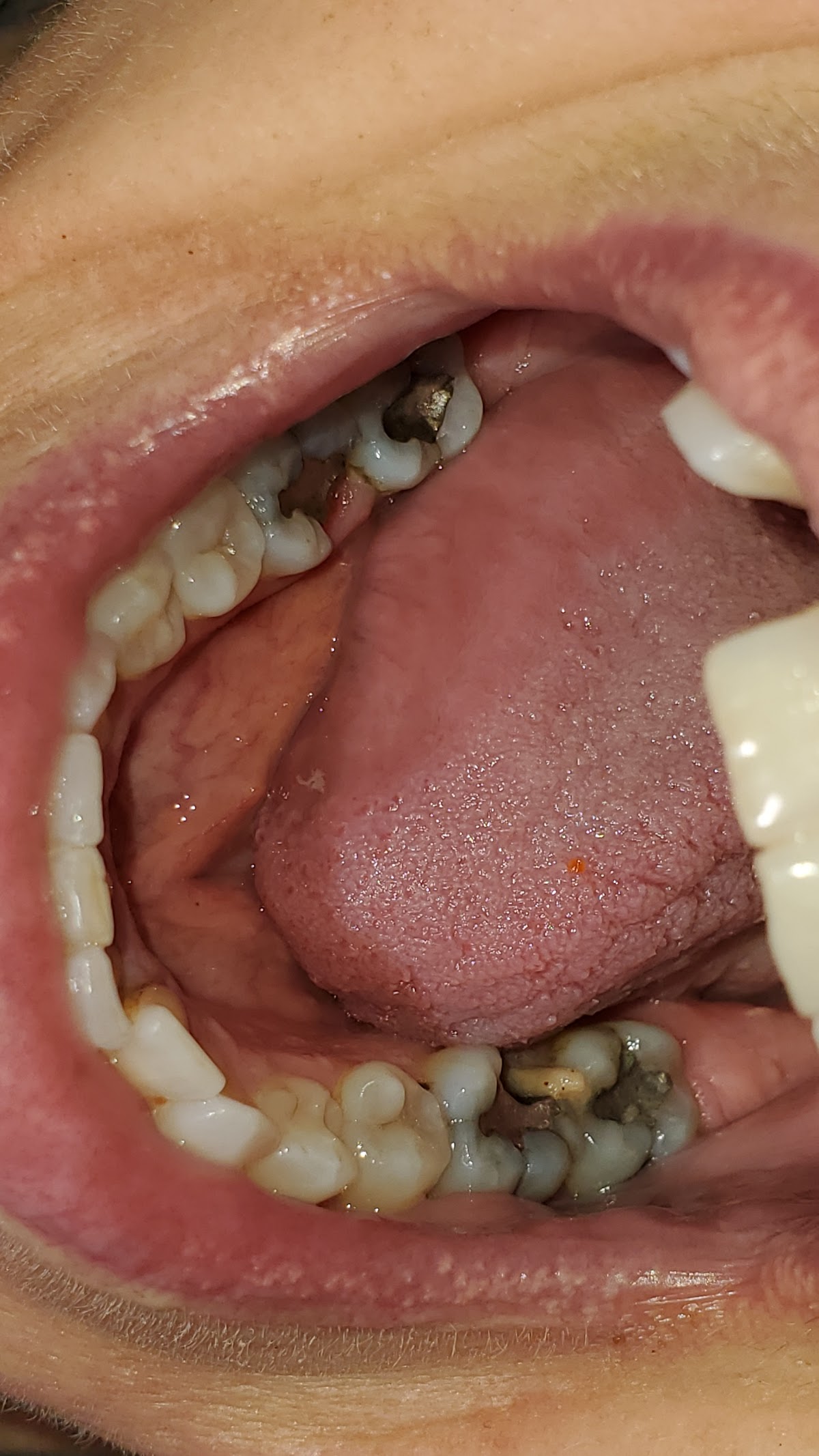 Precision Family Dentistry of Merced - Nathan Miller DDS, Jeremy Skinner DDS photo 4