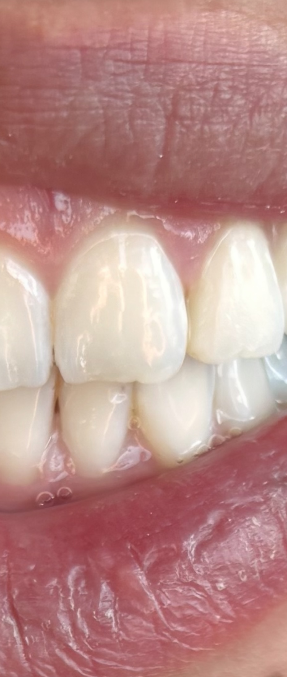 Precision Family Dentistry of Merced - Nathan Miller DDS, Jeremy Skinner DDS photo 5