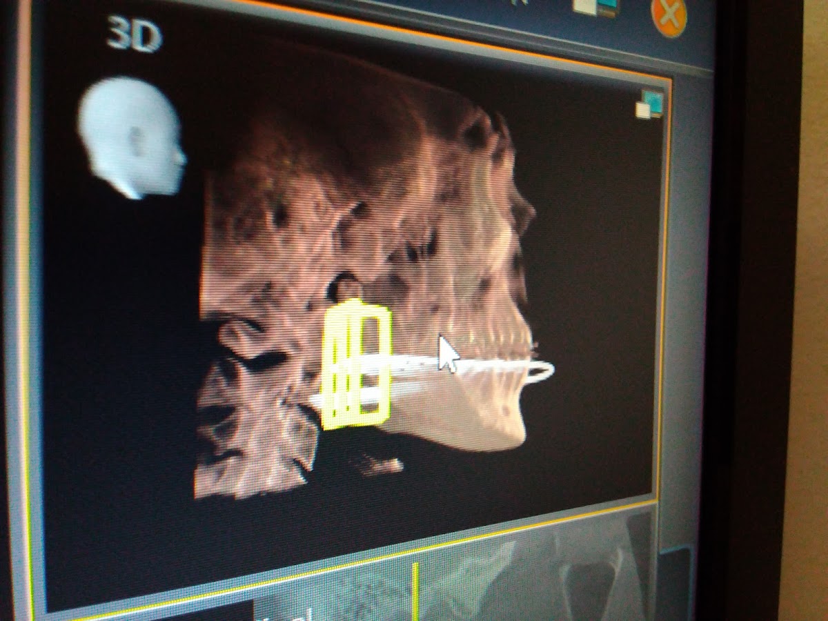 Precision Oral Surgery photo 5