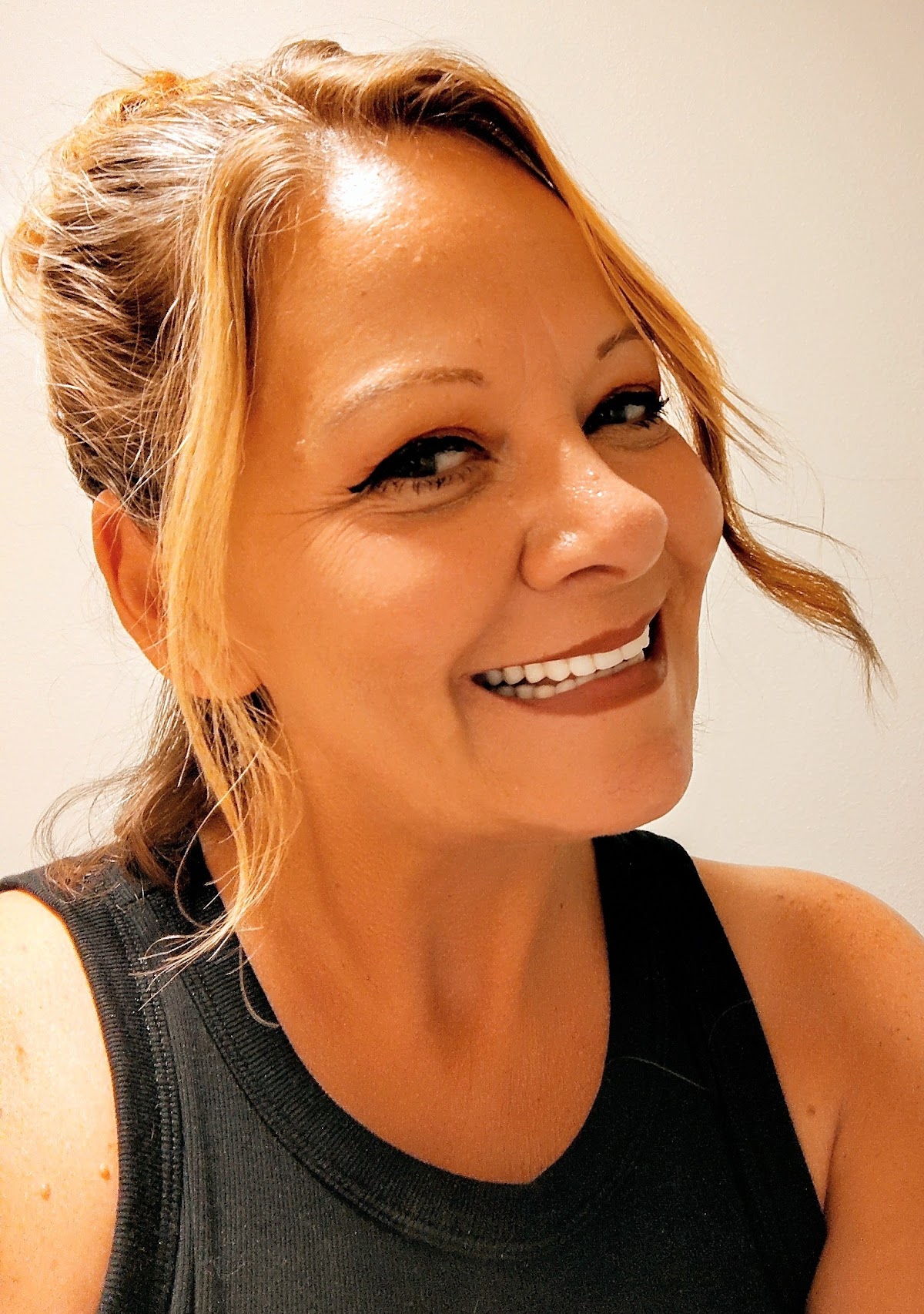 Affordable Dentures & Implants - Yakima photo 5