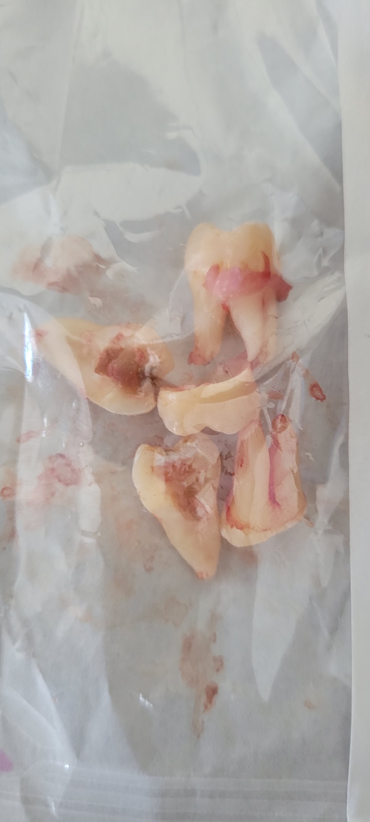 Aspen Dental - Berlin photo 3