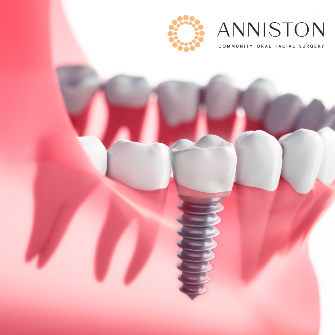 Anniston Oral Facial Surgery photo 6