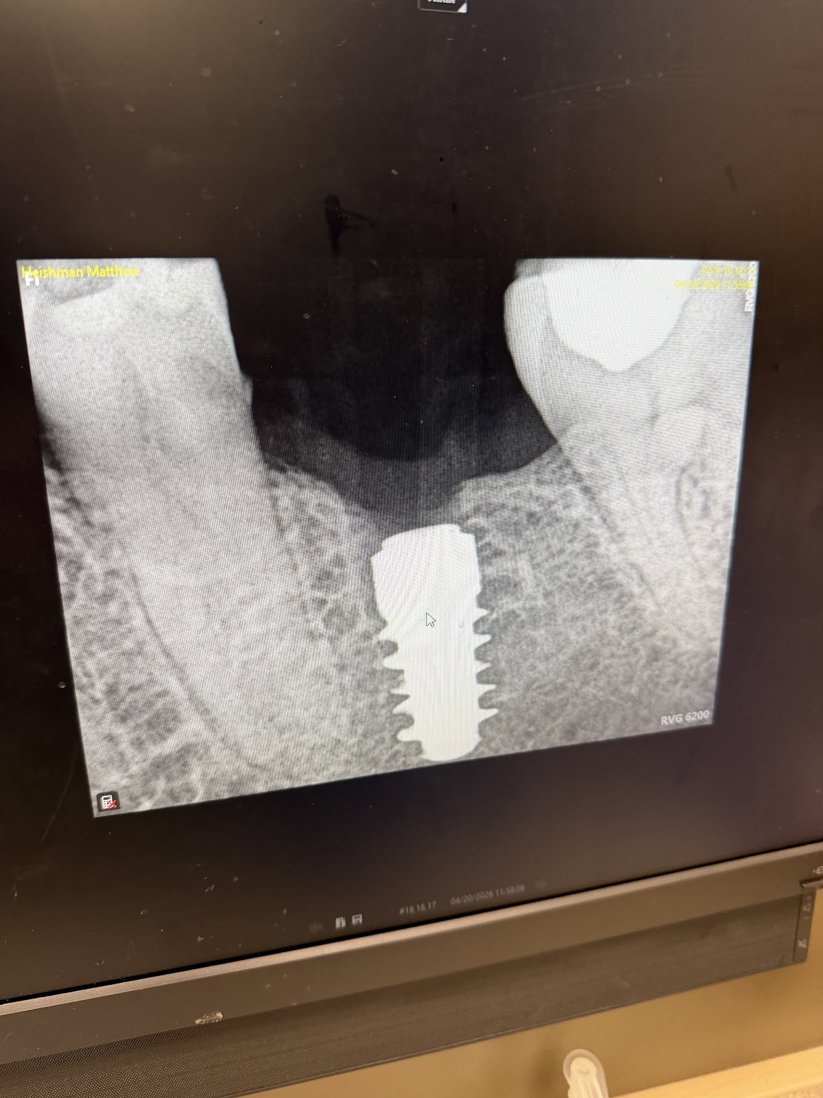 Aspen Dental - Fremont photo 3