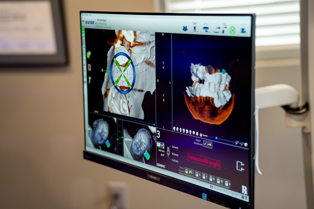 Hermitage Cosmetic and Implant Dentistry photo 6