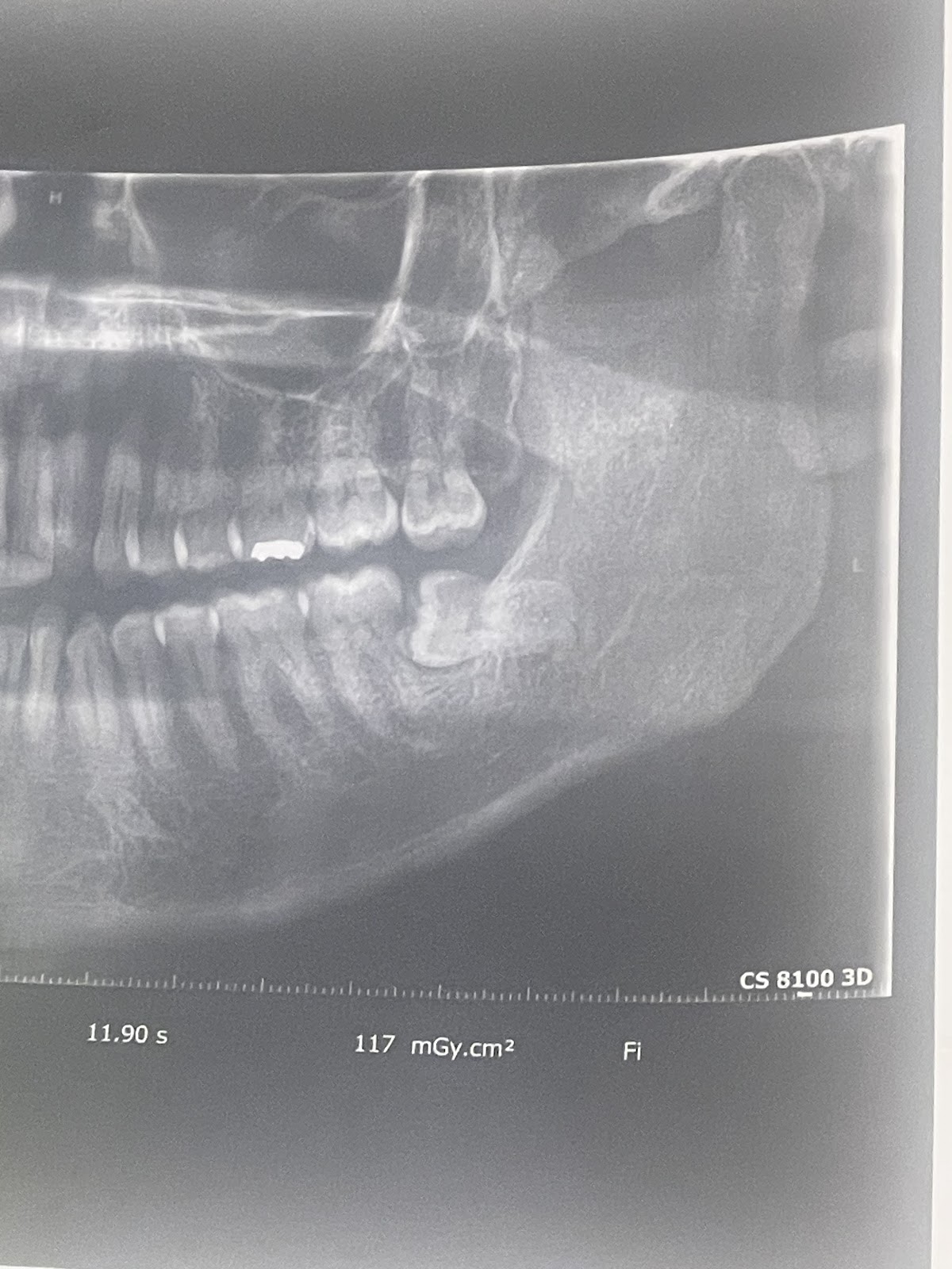 Affordable Dentures & Implants - Macon photo 5