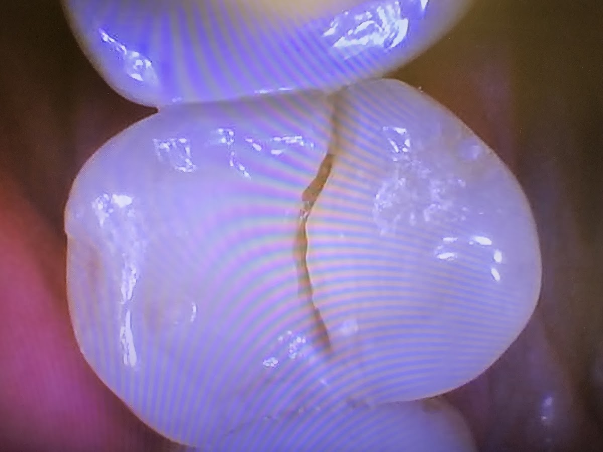 Advanced Dental Services photo 6
