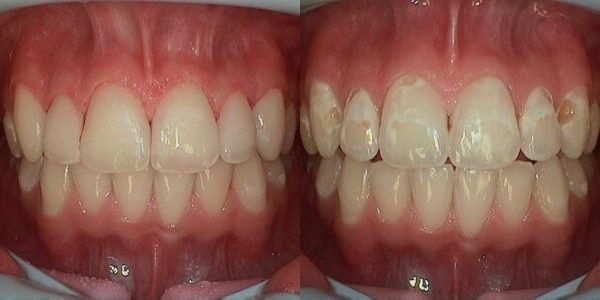 Haws Family Dentistry photo 5