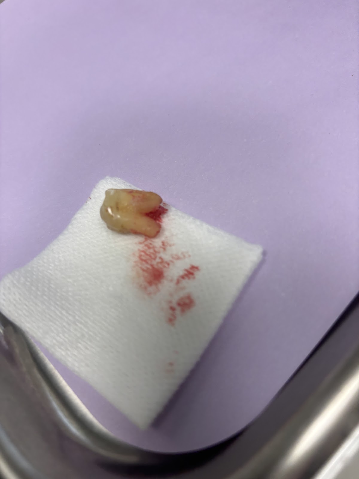 Aspen Dental - Grand Forks photo 1