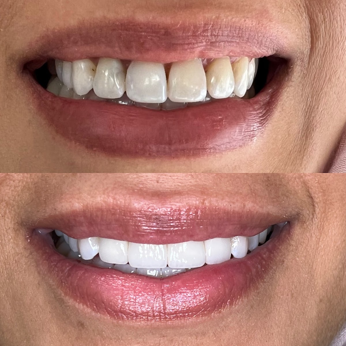 Advanced Dentistry By Soboh Liswi Tedini photo 2