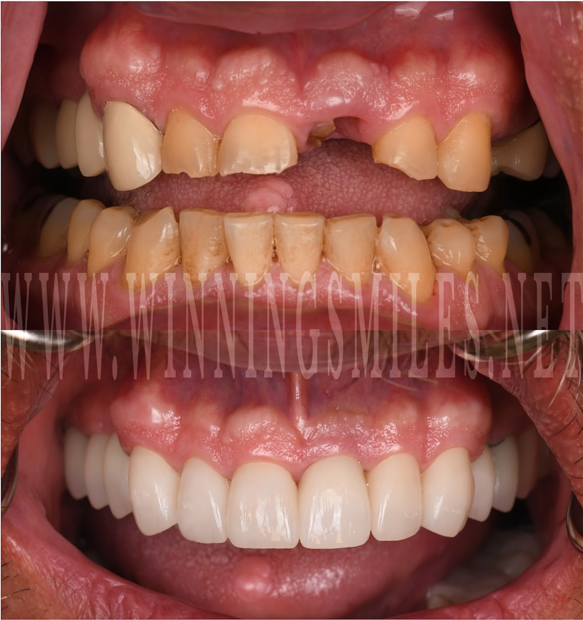 Winningsmiles Custom Dentistry & Implant Center photo 2