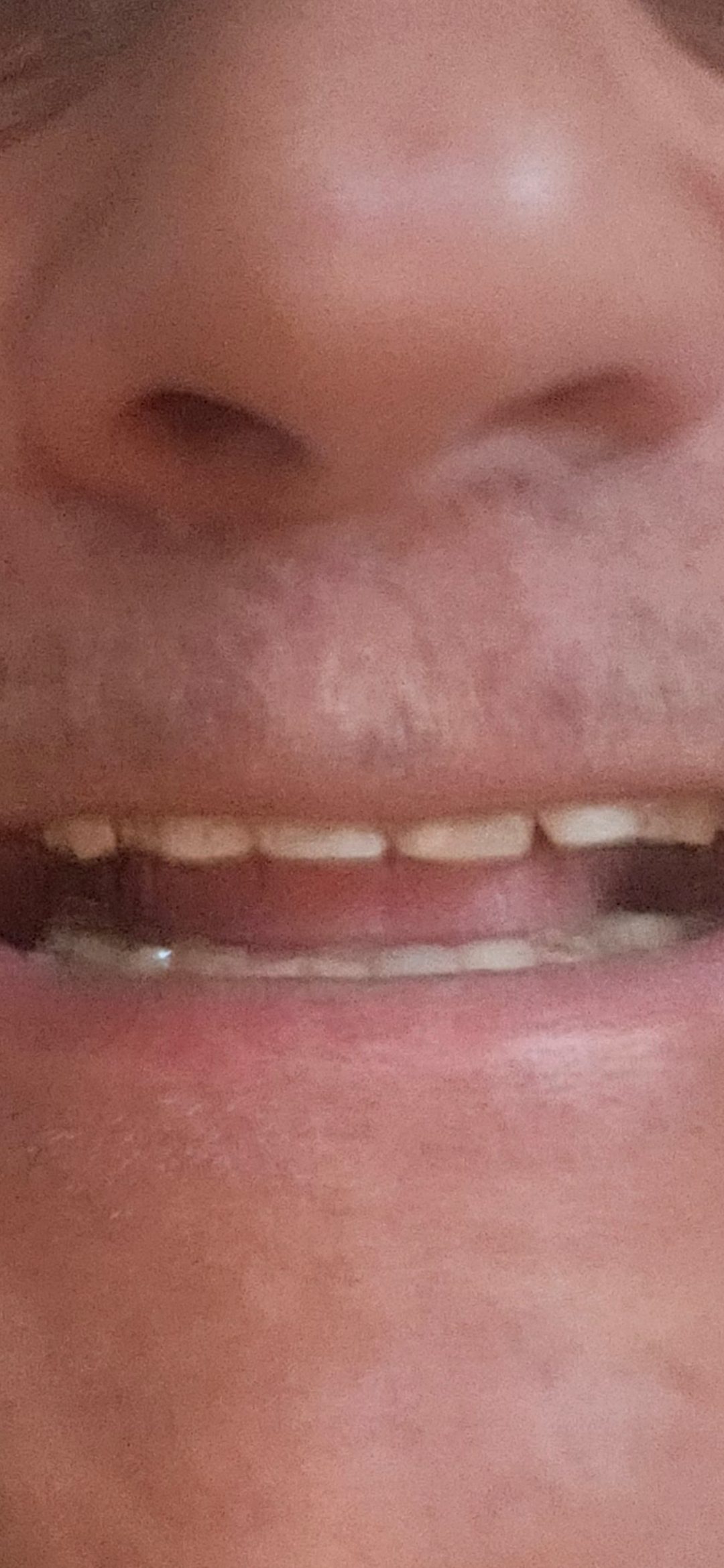 Krish Family Dental photo 6