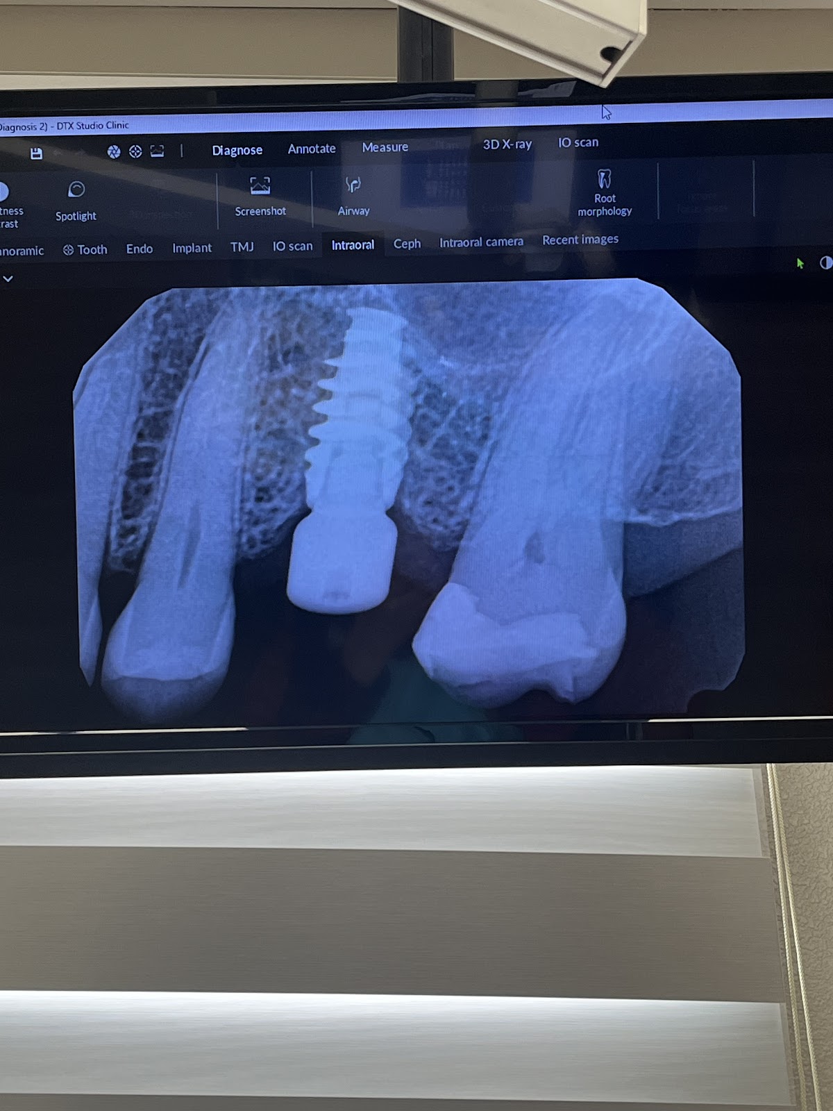 Firewheel Dental Implants & Periodontics photo 4