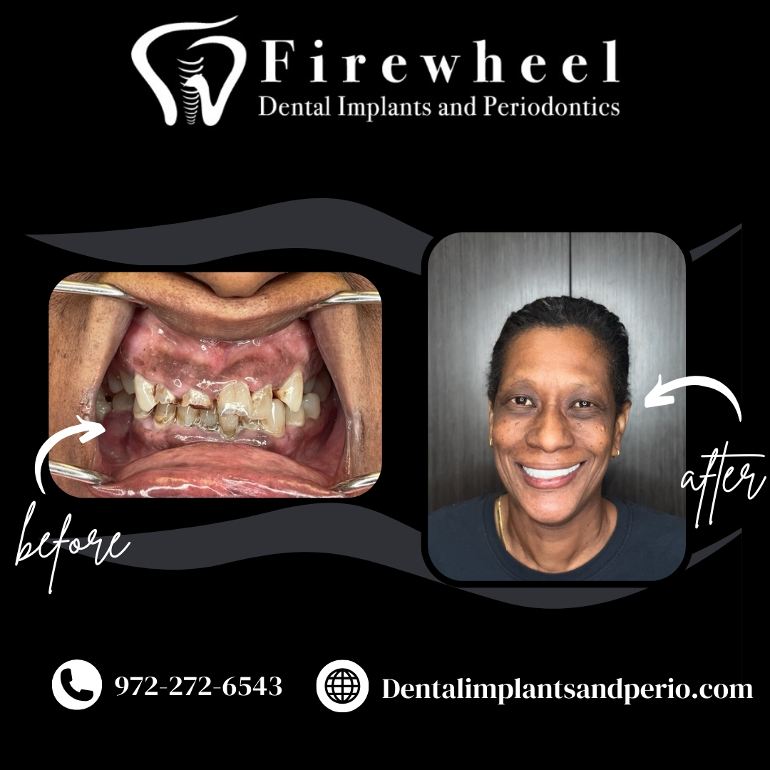 Firewheel Dental Implants & Periodontics photo 5