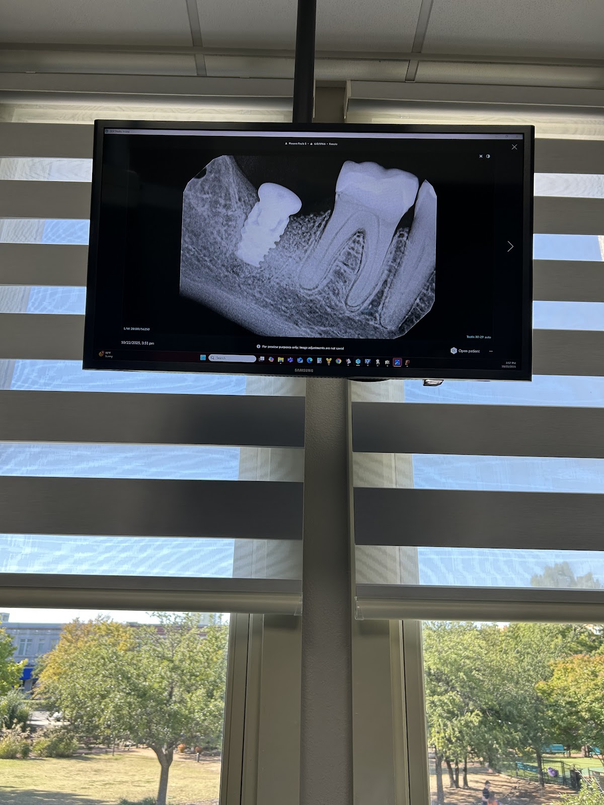 Firewheel Dental Implants & Periodontics photo 6