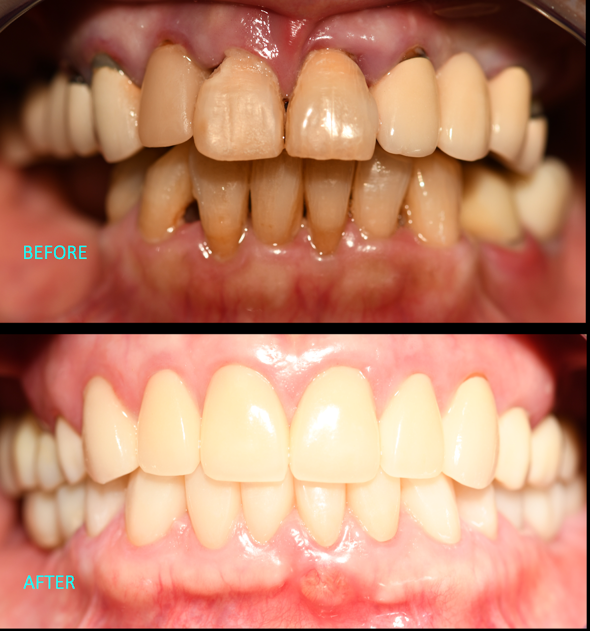 Advanced Implant Dental photo 5