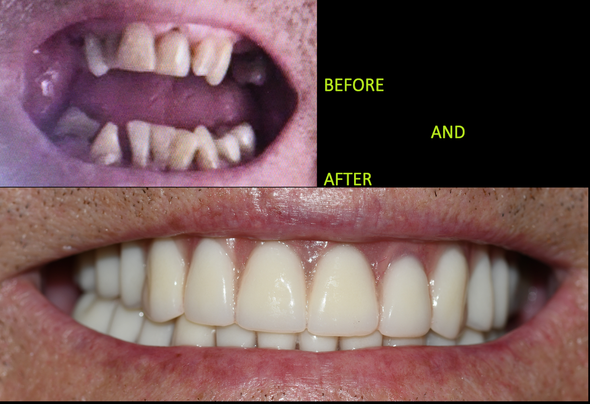 Advanced Implant Dental photo 6