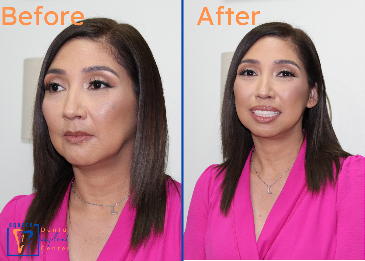 Square 1 Dental Implant Center photo 3