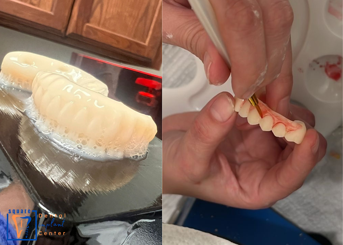 Square 1 Dental Implant Center photo 4