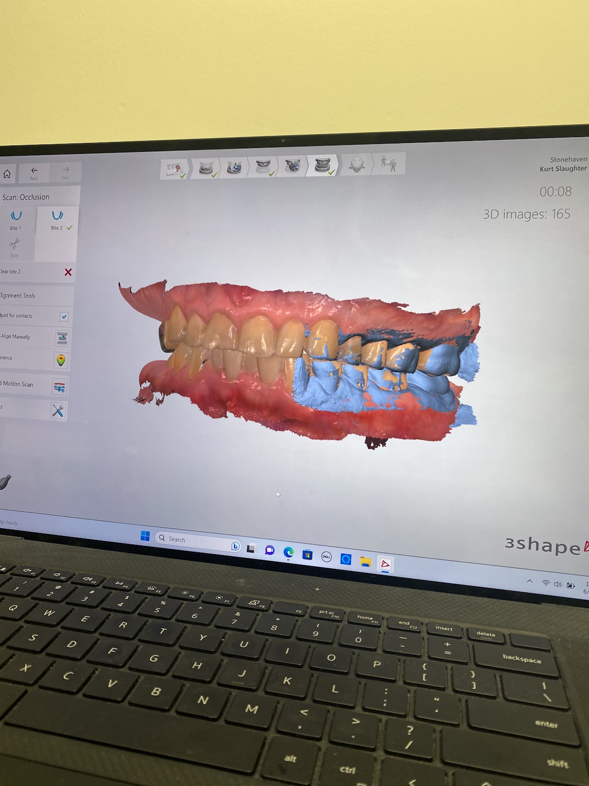 Stonehaven Dental & Orthodontics - Waco photo 5