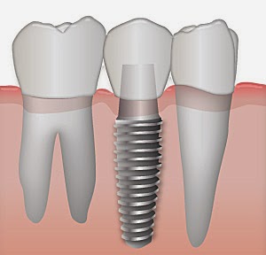 Eastlake Center for Implants and Restorative Dentistry photo 5