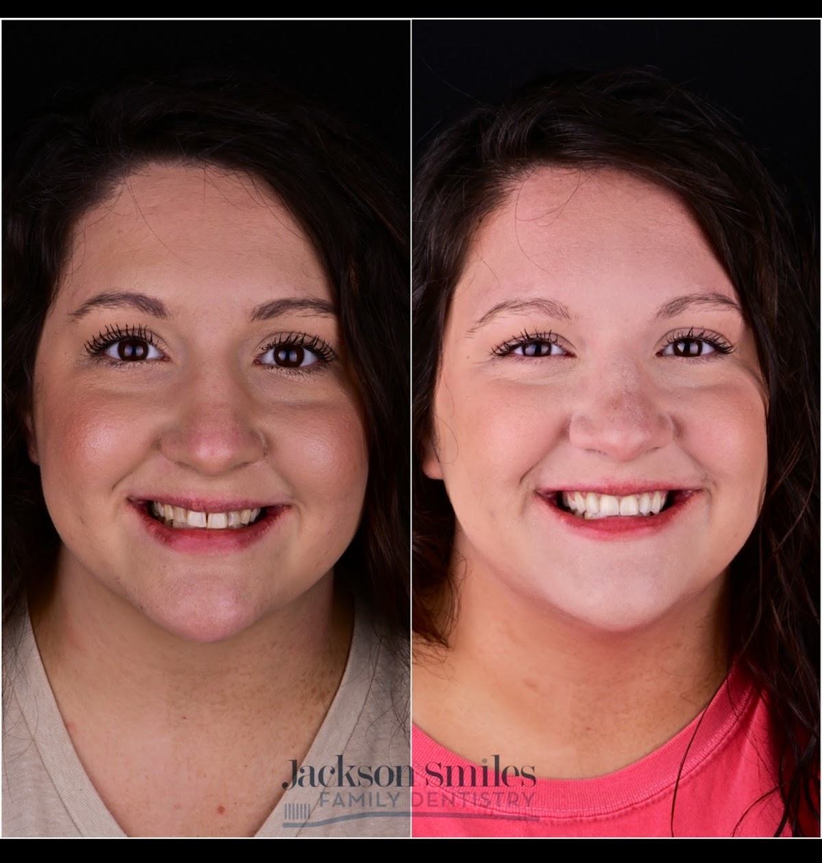 Jackson Smiles Family Dentistry photo 6