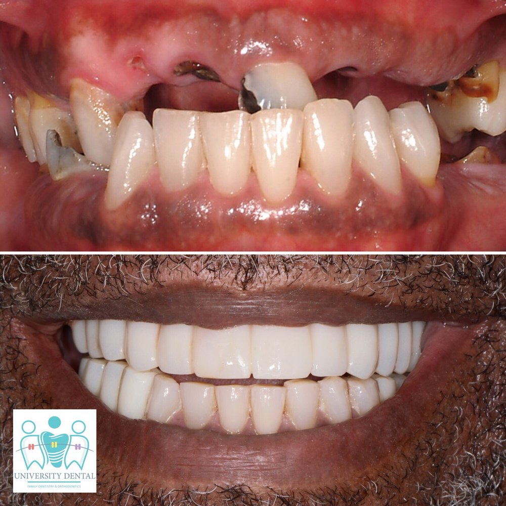 University Dental Implant Center photo 2