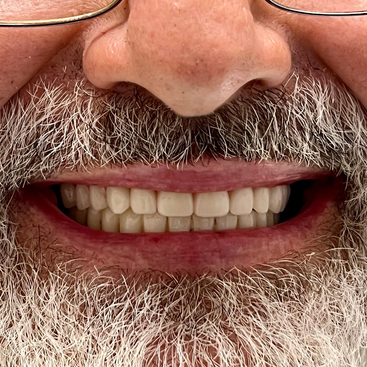 University Dental Implant Center photo 6