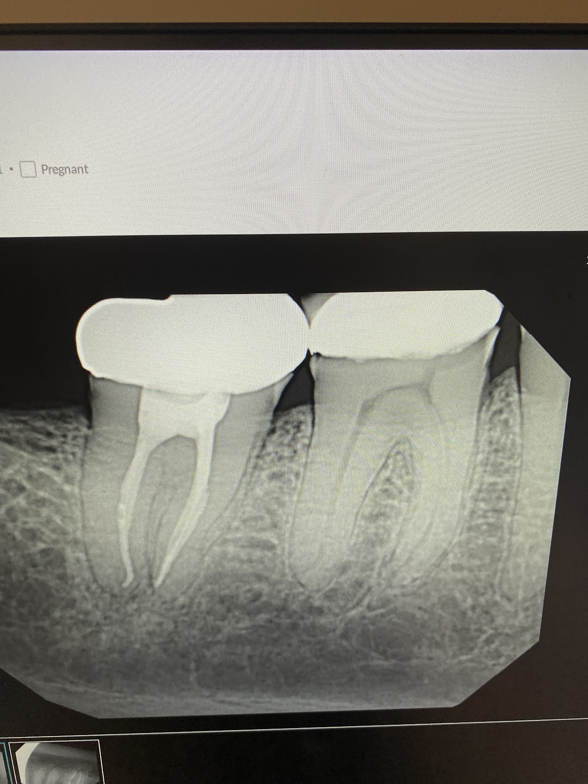 Liles Family Dentistry photo 6