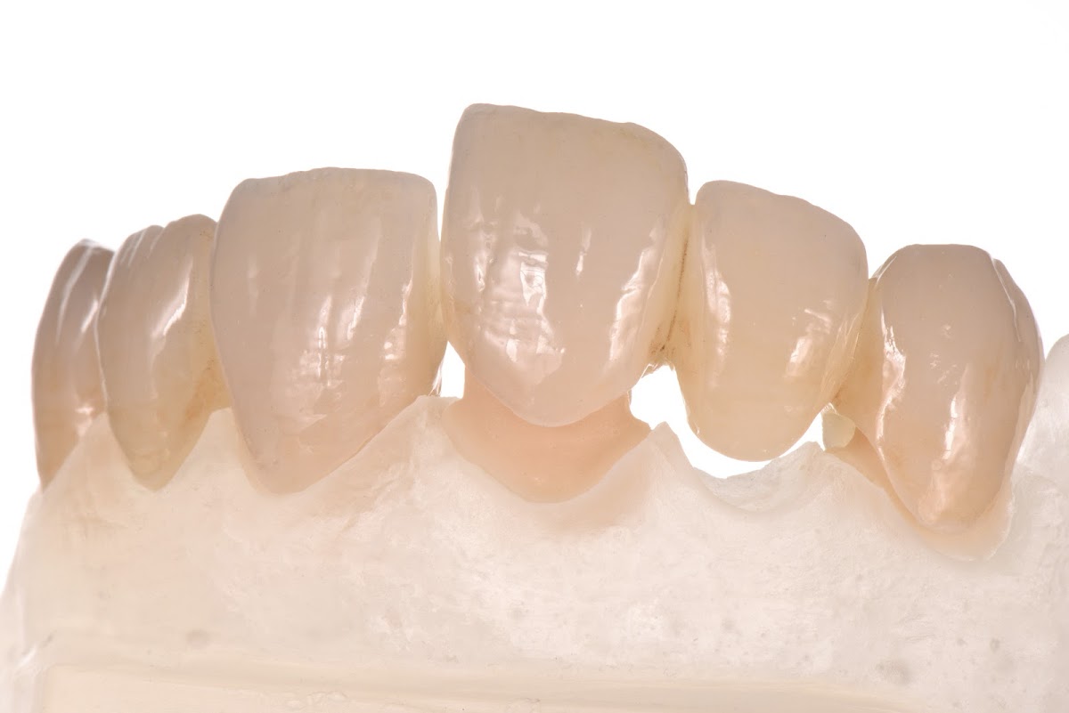 Mountain Dental Lab, Inc. photo 2