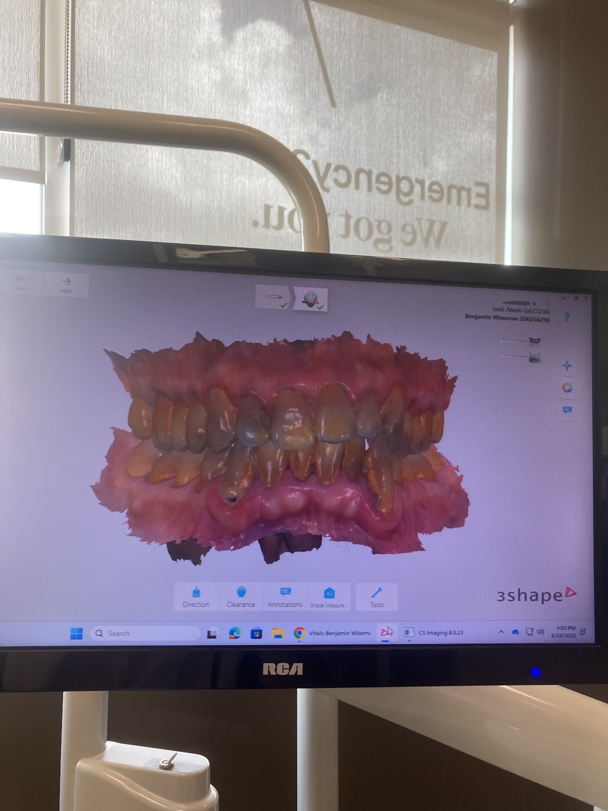 Aspen Dental - Waco photo 2