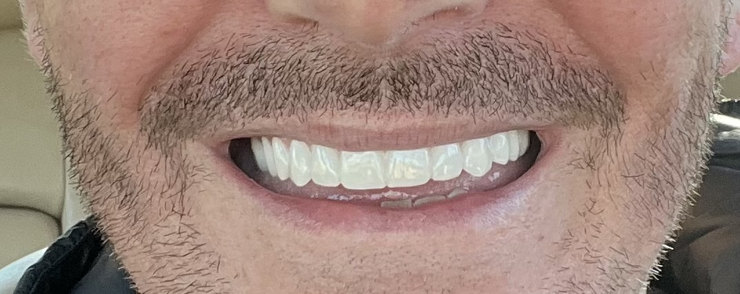 Designer Dental Group -all on 4 Implant Center photo 6