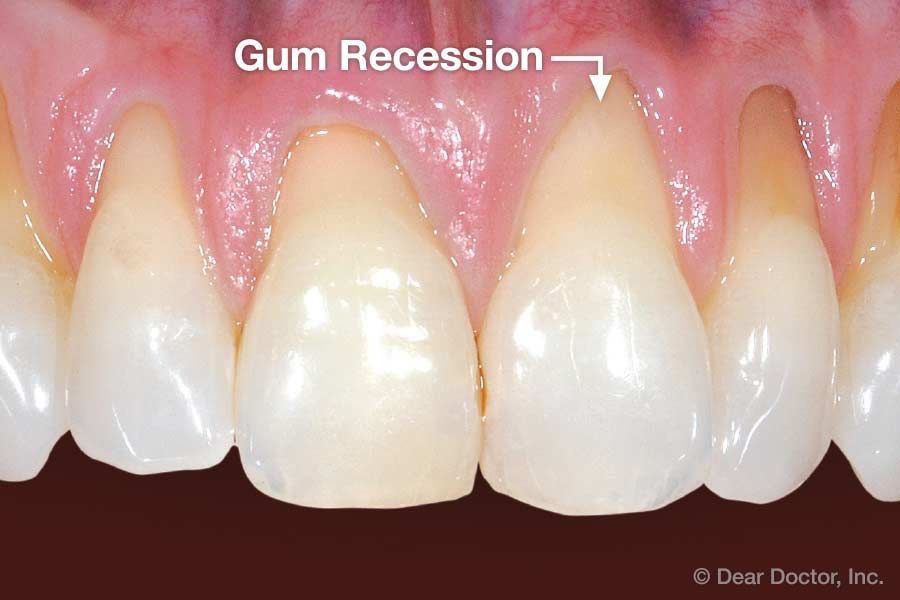 Advanced Periodontics & Implant Dentistry of Westchester photo 4