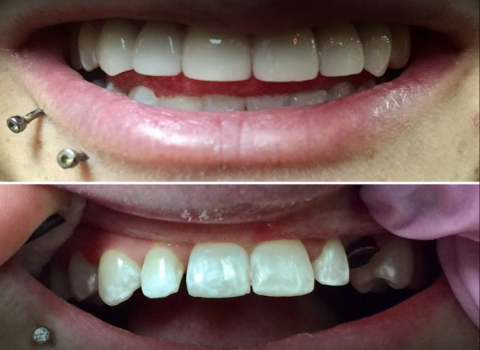 Laurence Palmer, DDS photo 6