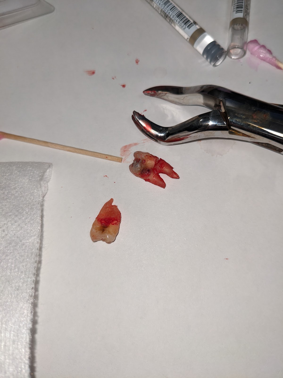 Aspen Dental - Mesa photo 6