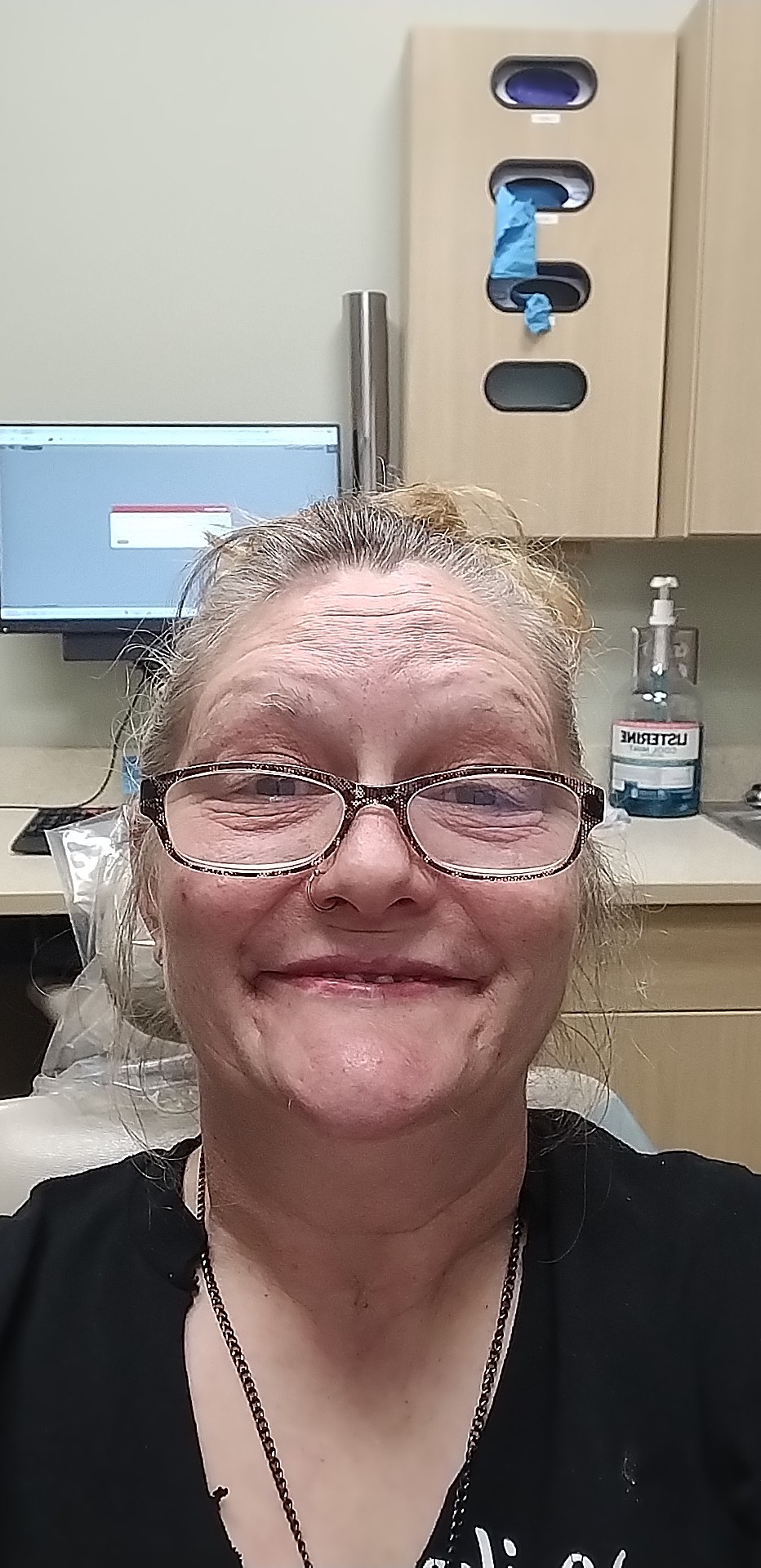 Aspen Dental - Crawfordsville photo 6