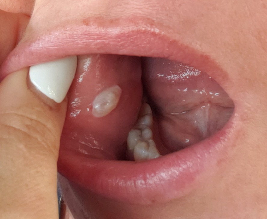 Inlet Premier Implant & Cosmetic Dentistry photo 2