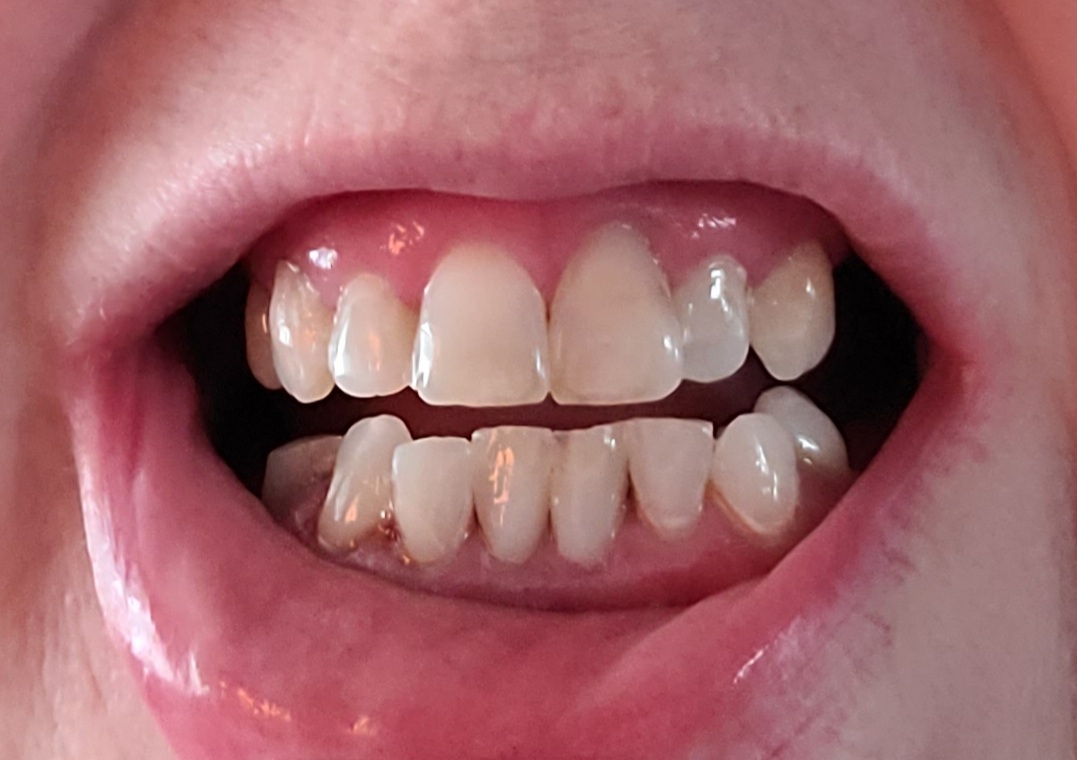 Inlet Premier Implant & Cosmetic Dentistry photo 3
