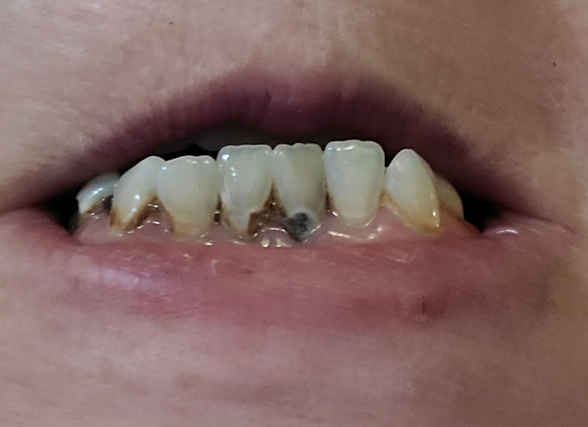 Inlet Premier Implant & Cosmetic Dentistry photo 4