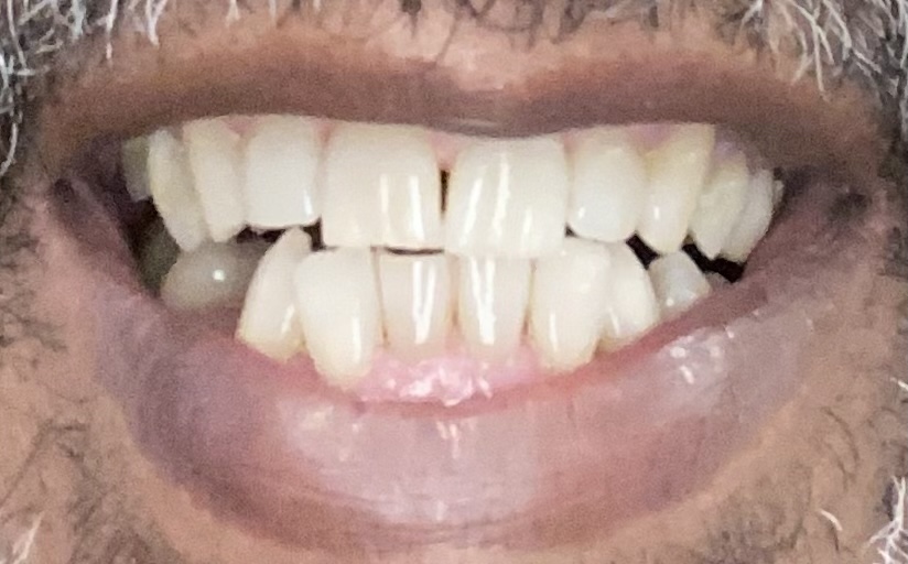 Eberhardt Dentistry: Kyle S. Eberhardt DDS photo 2